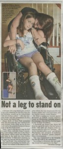 Not a Leg to Stand On